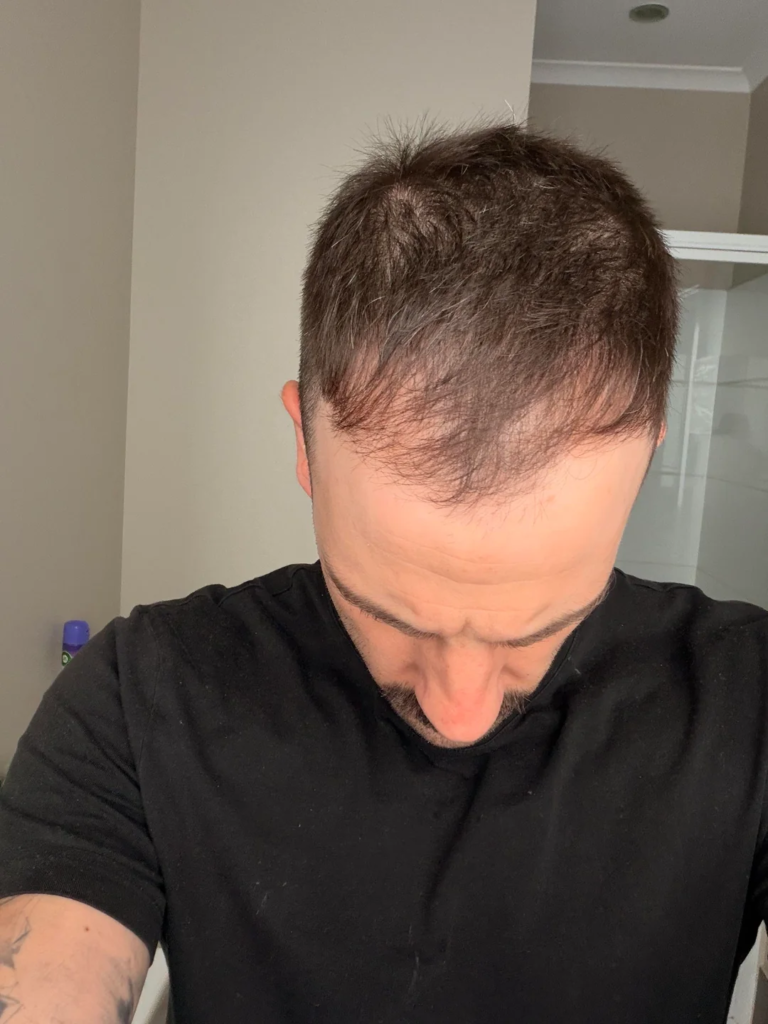 Image #2 from sv
