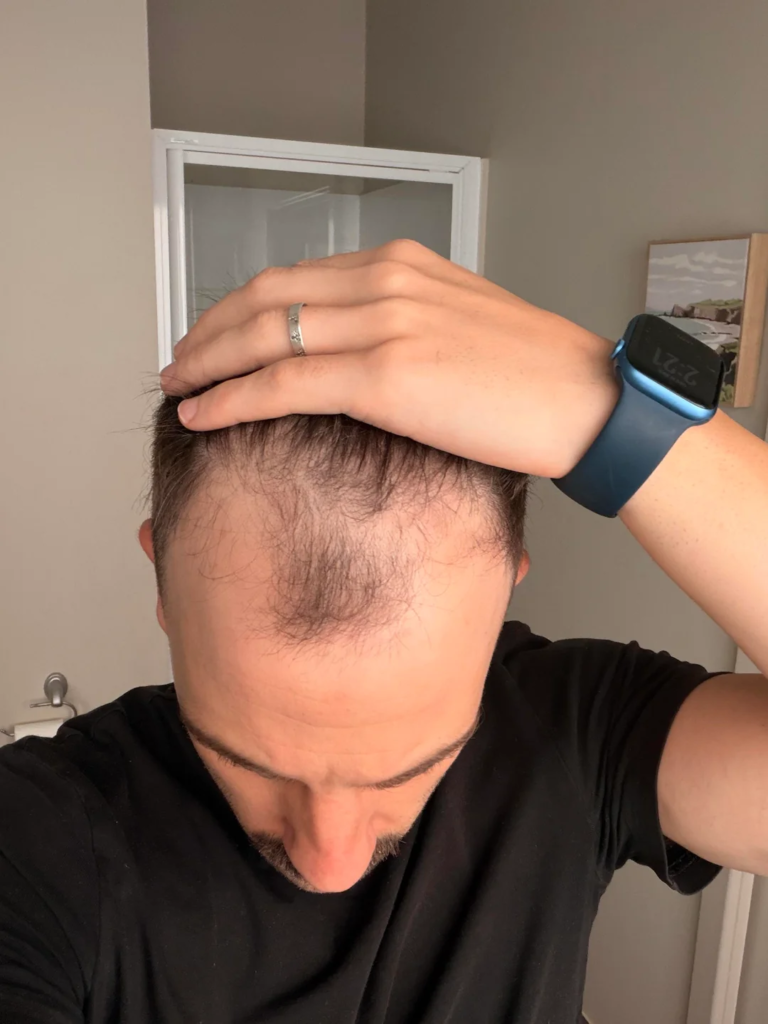Image #1 from sv